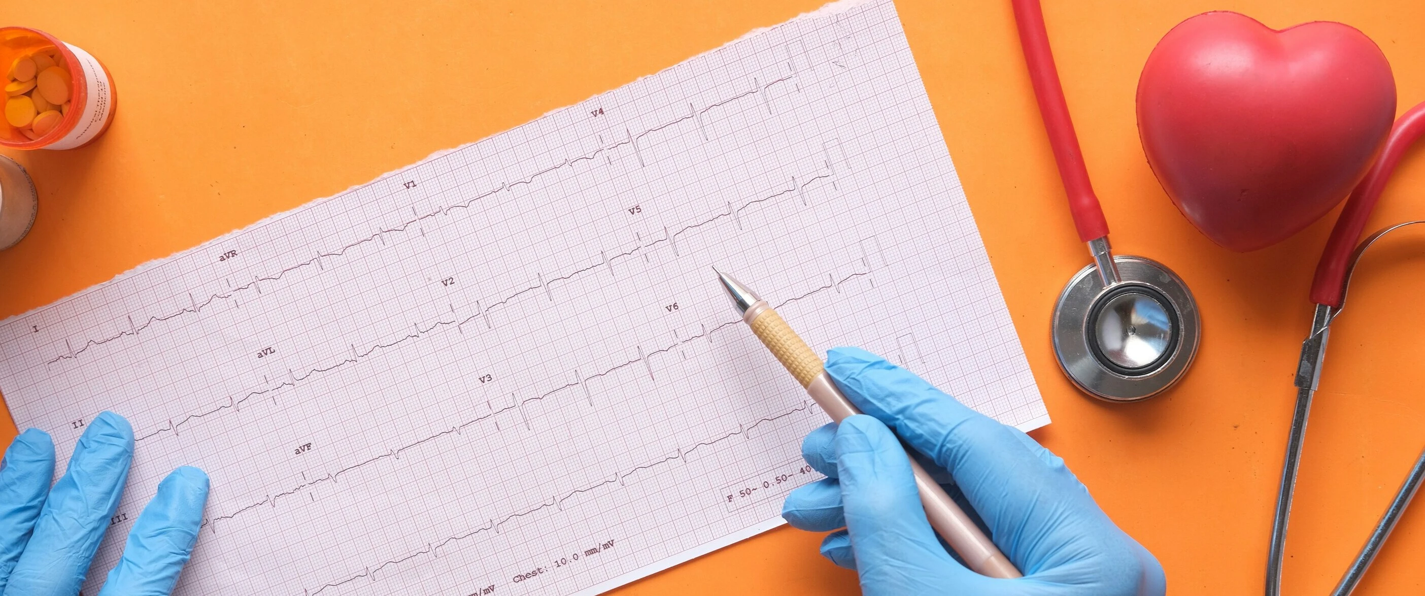 Image of electrocardiogram